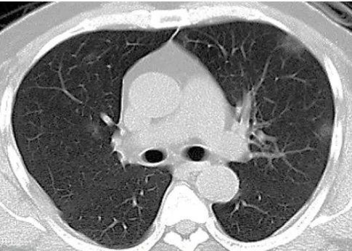 1月15日四川疫情新观察,防控策略调整下的区域应对与民生温度 1月15日四川疫情新观察,防控策略调整下的区域应对与民生温度