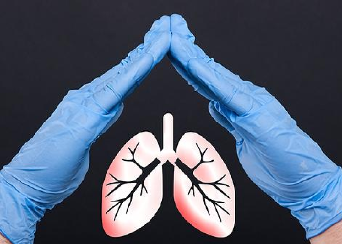 间接性肺炎,隐匿的健康威胁,这些症状需警惕 间接性肺炎,隐匿的健康威胁,这些症状需警惕