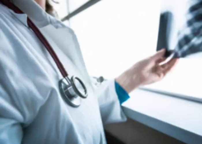 浙江绍兴3例新肺炎具体位置（绍兴三例新型肺炎）