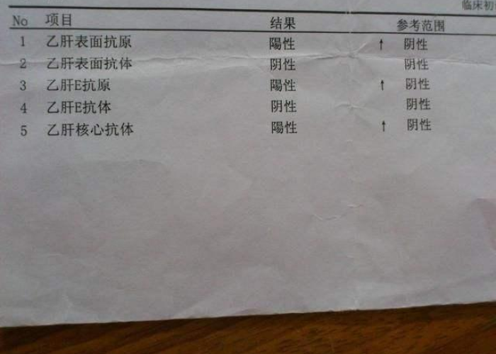 15阳性是小三阳还是大三阳/大三阳转小二阳意味着什么 15阳性是小三阳还是大三阳/大三阳转小二阳意味着什么