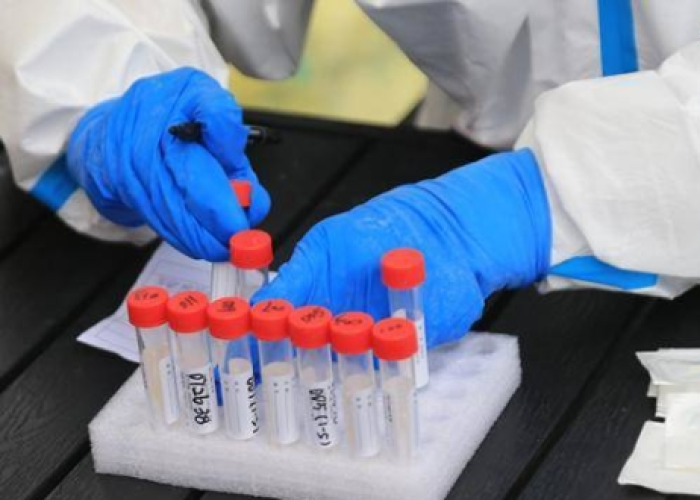 云南新增三例病例/云南新增三例病例是哪里的 云南新增三例病例/云南新增三例病例是哪里的