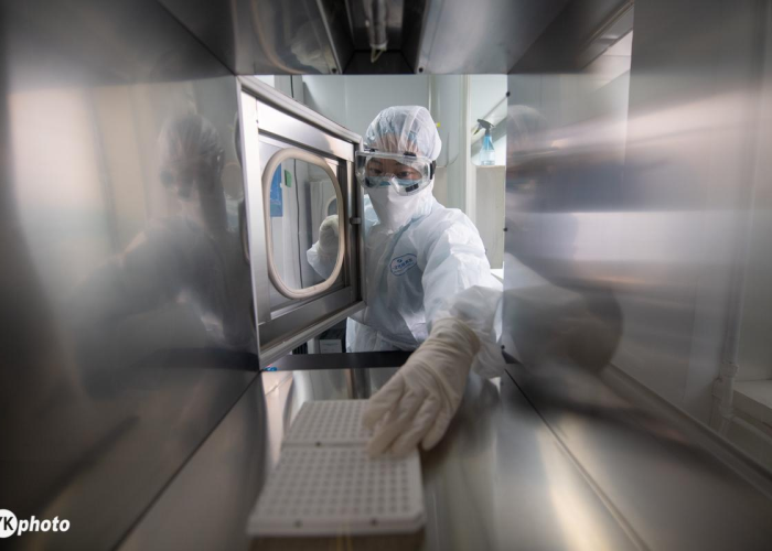 核酸结果一般多少小时(核酸检测结果几小时) 核酸结果一般多少小时(核酸检测结果几小时)