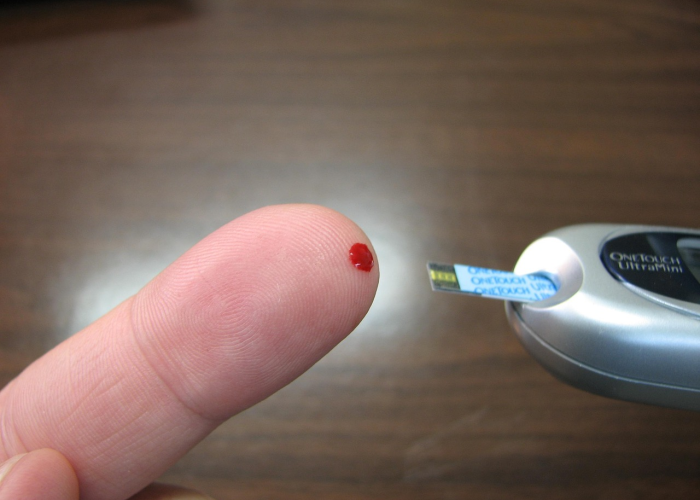 mers诊断标准:mers的早期表现 mers诊断标准:mers的早期表现