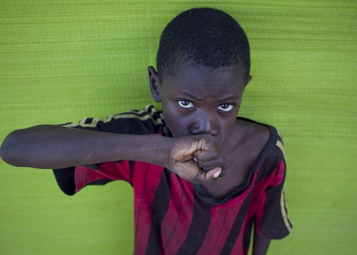 识图辨疾需谨慎,艾滋病皮肤症状图片背后的科学与误区 识图辨疾需谨慎,艾滋病皮肤症状图片背后的科学与误区