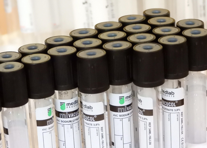 治愈出院后核酸检测为阳性，科学解读与理性应对